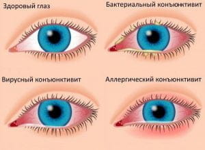 Причины возникновения